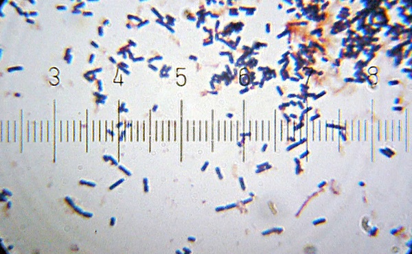 Hình ảnh vi khuẩn dưới kính hiển vi