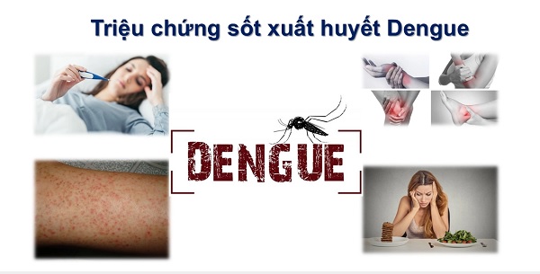 Các triệu chứng của sốt xuất huyết Dengue