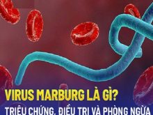 Bệnh Marburg là gì? Nguyên nhân, dấu hiệu, cách phòng tránh
